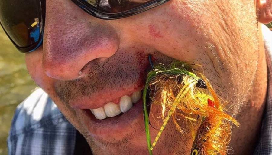 how to remove a fishing hook - photo of a fly angler with a large streamer fly hook embedded in his face just above his upper lip.